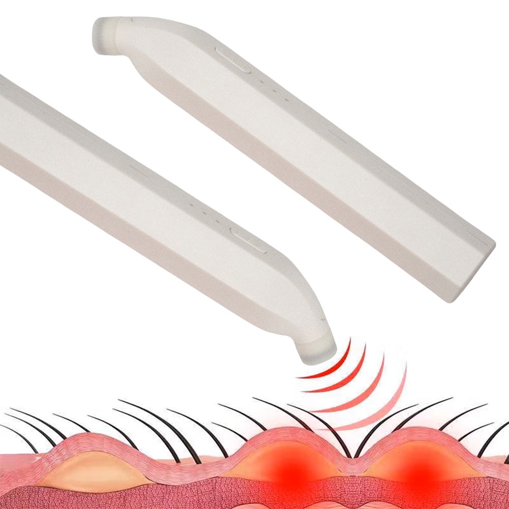 Yguping Electronic Mosquito Bite Pen Natural Portable Mosquito Insect