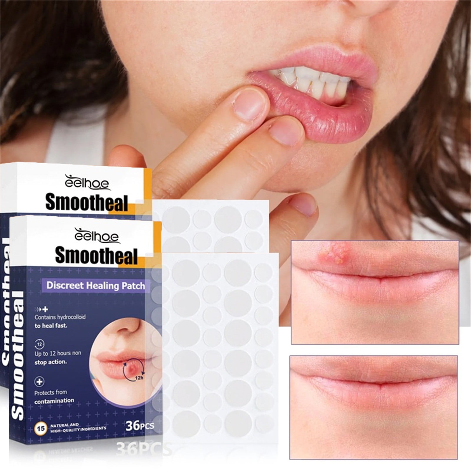 YiFudd Cold Sore Smootheal Patches Cold Sore Discreet Healing Patches