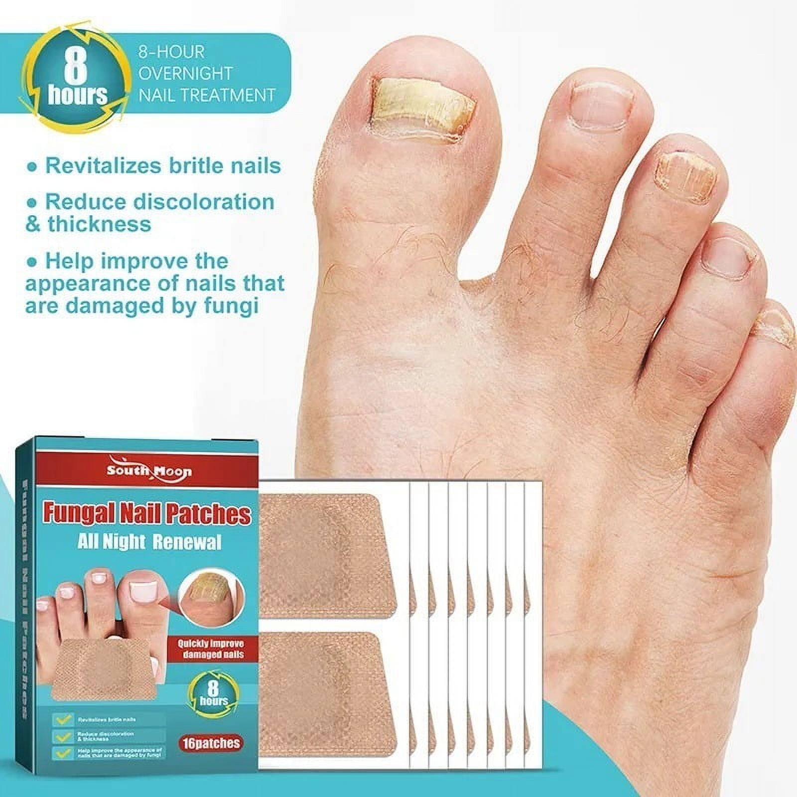 Yiget 16Pcs Fungal Nail Patches Ingrown Toenail Corrector Anti Fungal