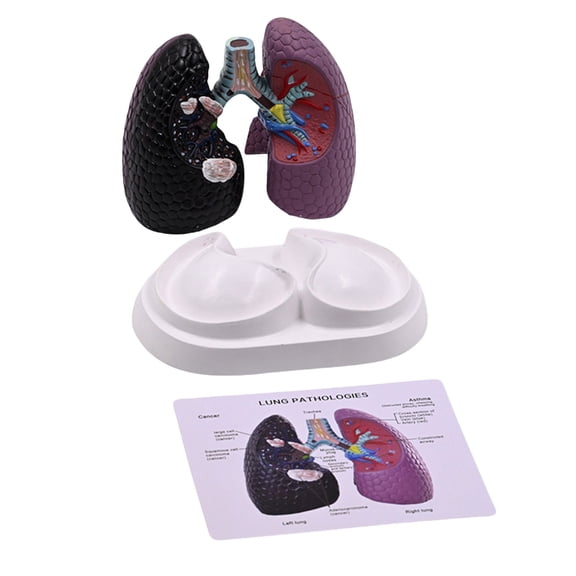 Yokua Pathological Lung Anatomy Model Human Anatomical Lung Model Teaching Tool