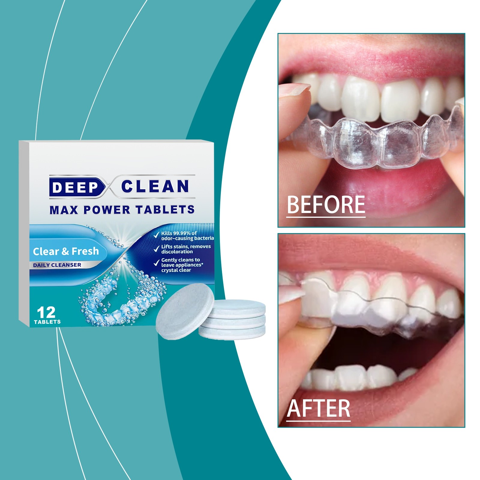 Yolmart Deep Cleaning Maximum Effect Braces Cleaning Tablets Stains And