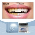 Yolmart Gentle Teeth Toothpaste With And Stain Removing Properties For