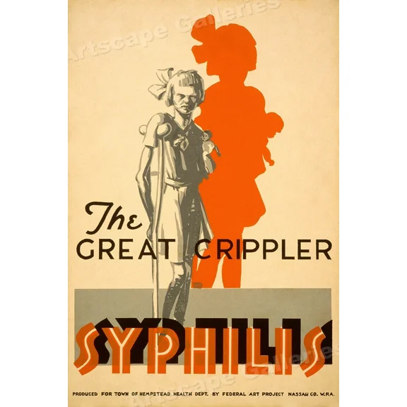 Young Girl With Syphilis Vintage Style 1936 Wpa Public Health Poster Home Decor Office Wall Art