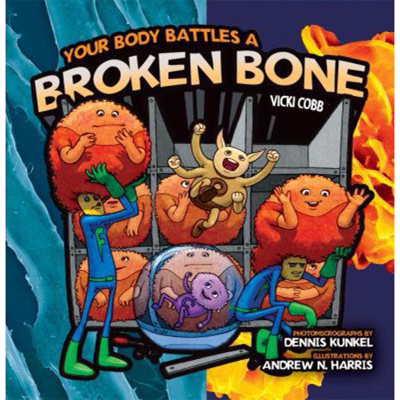 Pre-Owned Your Body Battles a Broken Bone (Paperback) 1580138349 9781580138345