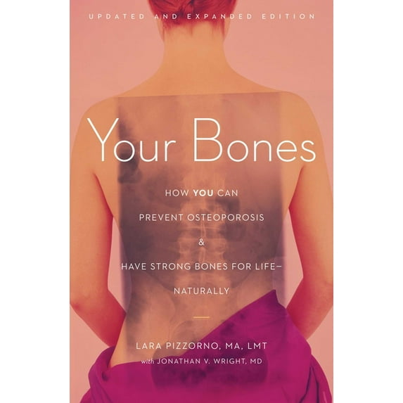 Your Bones: How You Can Prevent Osteoporosis and Have Strong Bones for Life--Naturally, (Paperback)