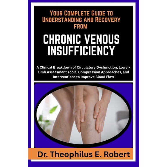 Your Complete Guide to Understanding and Recovery from Chronic Venous Insufficiency: A Clinical Breakdown of Circulatory, (Paperback)