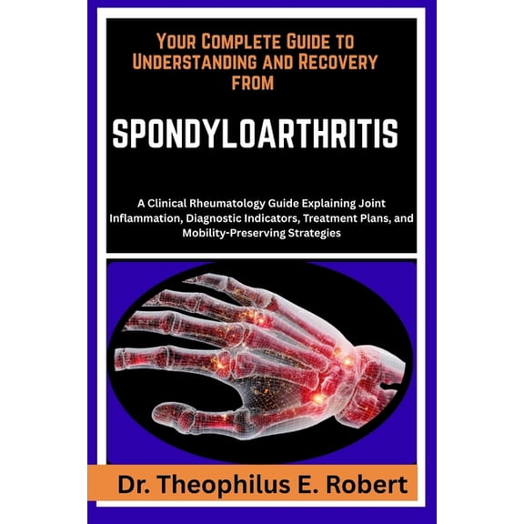 Your Complete Guide to Understanding and Recovery from Spondyloarthritis: A Clinical Rheumatology Guide Explaining Joint, (Paperback)