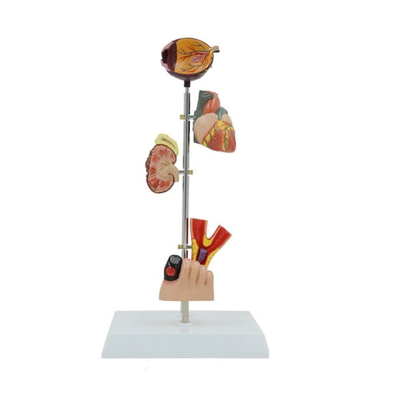 Youthyao Anatomical Kidney Model, Pathological Human Kidney Blood Vessel Foot Eye Anatomy Model Educational Teaching