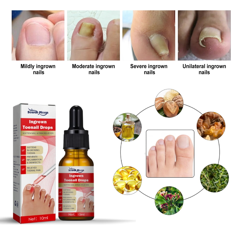 Dr. Scholl's Ingrown Toenail Pain Reliever - 8.5 oz pkg | Stop & Shop