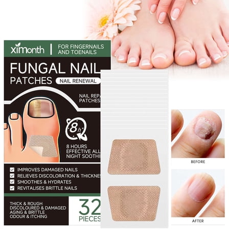 Yuelianxi Extra Strength Toenail Fungus Treatment Patches, Nail Repair Pads for Discolored Nails, Breathable Overnight Nail Care, 32 Pcs