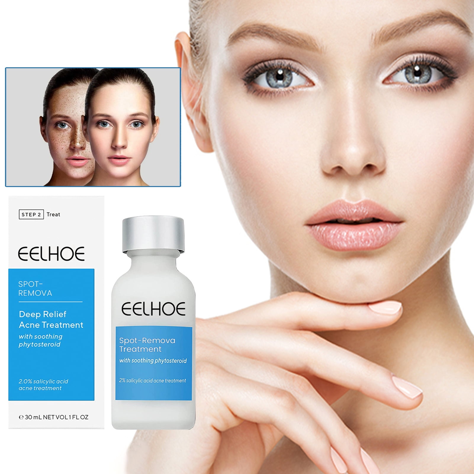 Yuxuan EELHOE Skin Repair Lotion Effective Nonirritating Reduce Dark