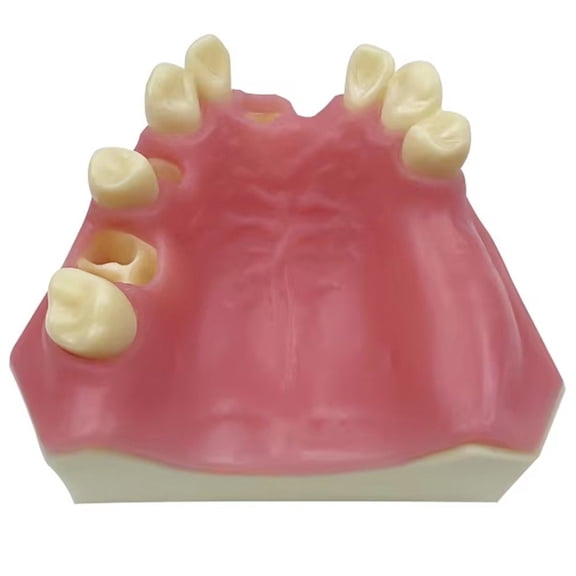 Yvsxxv Lower Jaw Missing Teeth Implant Display Science Models 1Pc