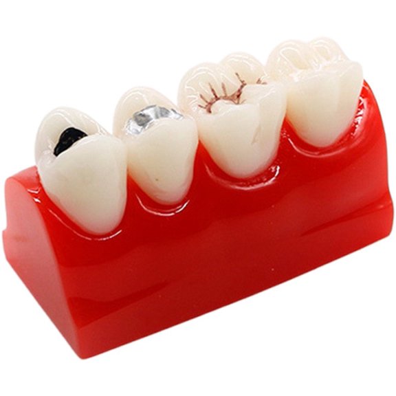 Yvsxxv PVC Tooth Pit Fissure Sealing Display Science Models 1Pc