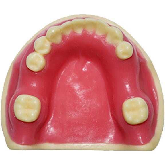 Yvsxxv Resin Missing Teeth Implant Display Science Models Style1 1Pc