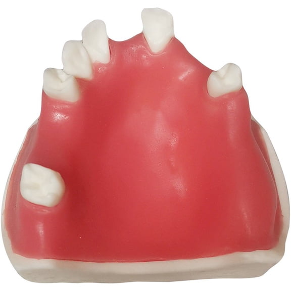 Yvsxxv Resin Missing Teeth Implant Display Science Models Style4 1Pc