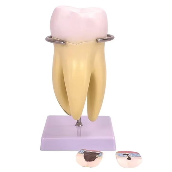 Yvsxxv Yellow PVC Detachable Molar Display Science Models B 1Pc