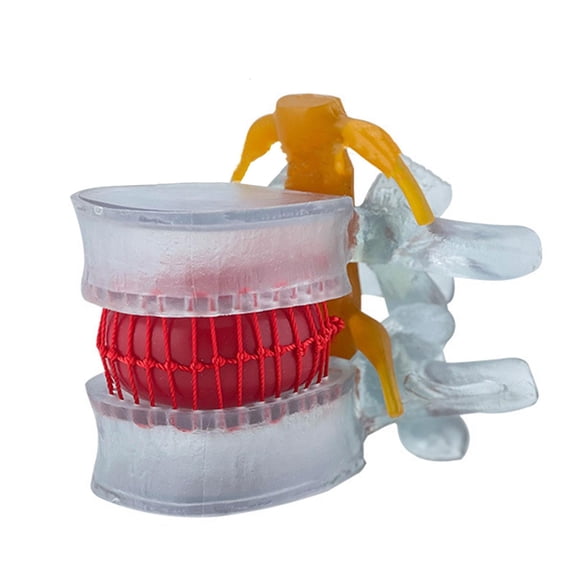 Ywmsfl Anatomical-Lumbar Spine Model with Movable Lumbar Disc for Medical Study