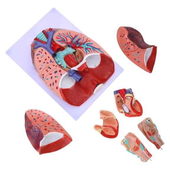 Ywmsfl Lung Anatomy Model for Educational Training Aid, Anatomical Heart Lung Throat Model Shows Details of Lung Trachea System