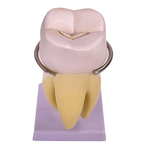 Ywmsfl Molar Tooth Model, Detachable Tooth Anatomy Model for Display of Scientific Research in Medical and Clinic Settings