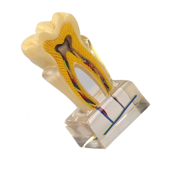 Ywmsfl Professional Tooth Anatomy Model U6X Enlarged Anatomical Teeth and Model For Classroom Teaching Demonstration