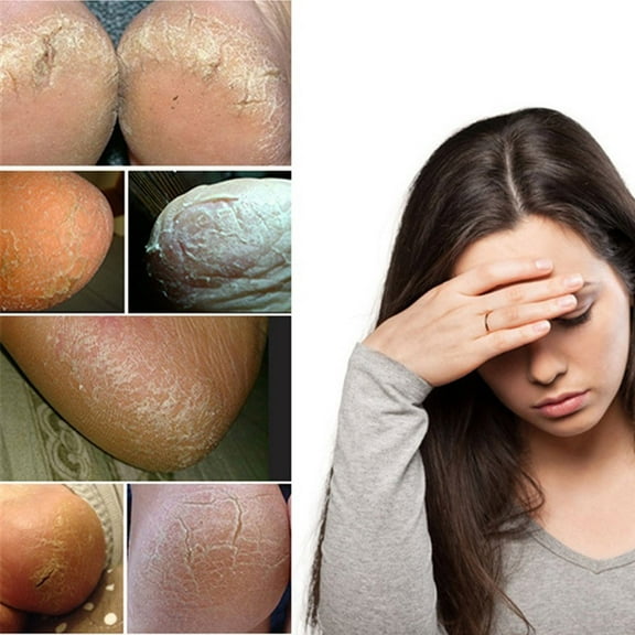 ZHENHONG Casual Socks for Women Gel Silicone Heel Dry Socks Unisex Moisturizing Protectors Foot Skin Socks