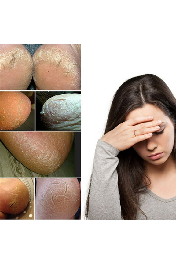 Casual Socks for Women Gel Silicone Heel Dry Socks Unisex Moisturizing Protectors Foot Skin Socks