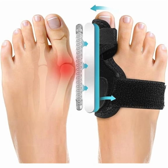 ZLC Bunion Corrector, Two Level Bunion Splint Big Toe Separator for Pain Relief, Hallux Valgus, Overlapping toe, Big Toe Straightener Day & Night Support for Women & Men (2 Pics)