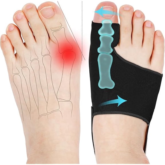 ZLC2PCS Bunion Corrector for Women & Men, Big Toe Straightener with Splint & Pads, Comfortable & Breathable for Day/Night Support, Hallux Valgus Pain Relief Non-Slip Socks