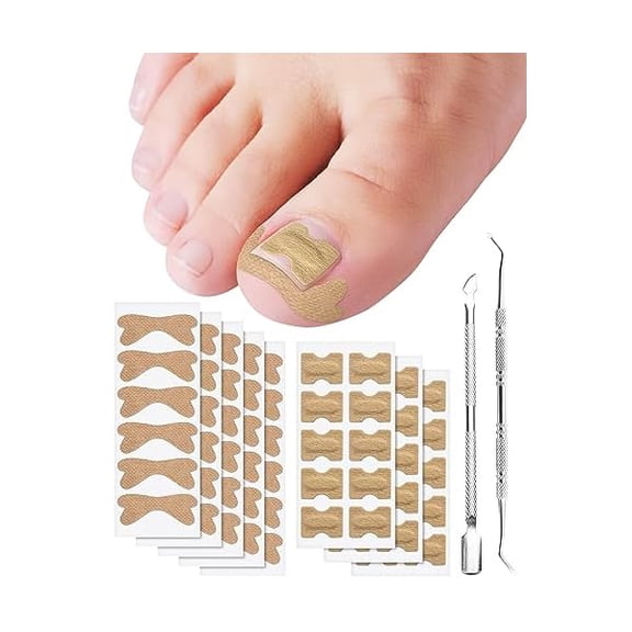 ZLCIngrown Toenail Correction Treatment Tool, 60Pcs Ingrown Toe nail Corrector Patch in 2 Types, Professional Safe Ingrown Toenail Tool with 2 Pedicure Tools for Ingrown Toenail Remover