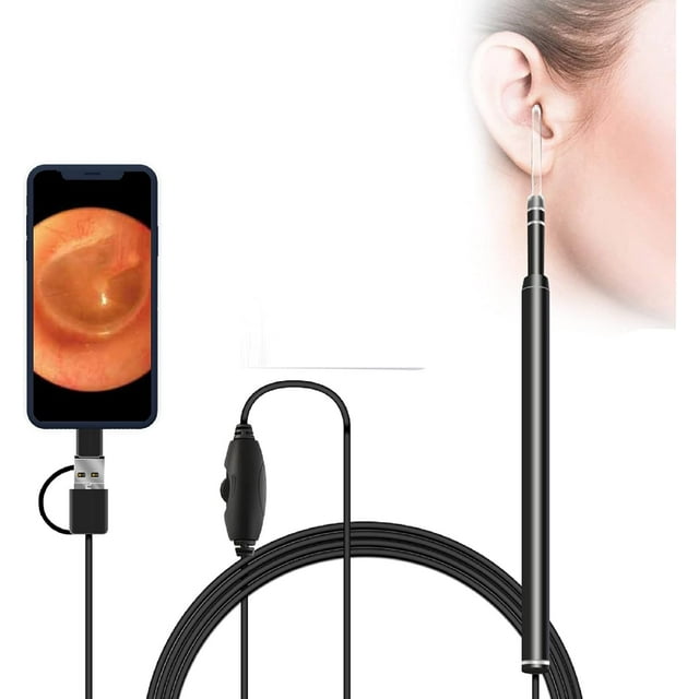 ZYEar Endoscope, 3 in 1 Ear Scope, 720P HD Waterproof Digital Led