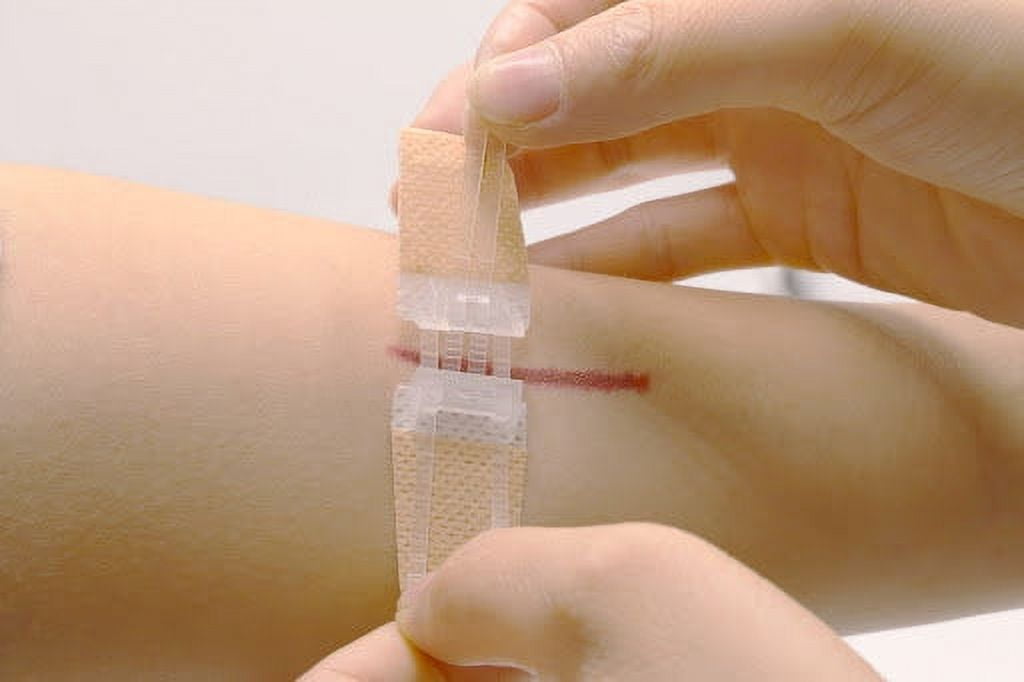 Zip Stitch Suture Wound Closure Device (3 pack)