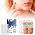 Zit Stickers for Face 144 Of And Wart Removal For Repairing Warts On