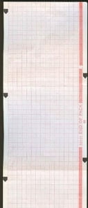 Zoll Medical Recorder Paper - 8000-0302BX - 10 Each / Box
