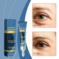 Zyooh Firming Eye Eye Lighten Fine Line Eye Bags Black Moisturizing Eye