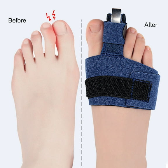 dianhelloya 1 Set Toe Support Splint Fastener Tape Design Soft Lining Adjustable Anti-abrasive Straighten Curved Pain Relief Toe Brace Tape Foot Care Blue
