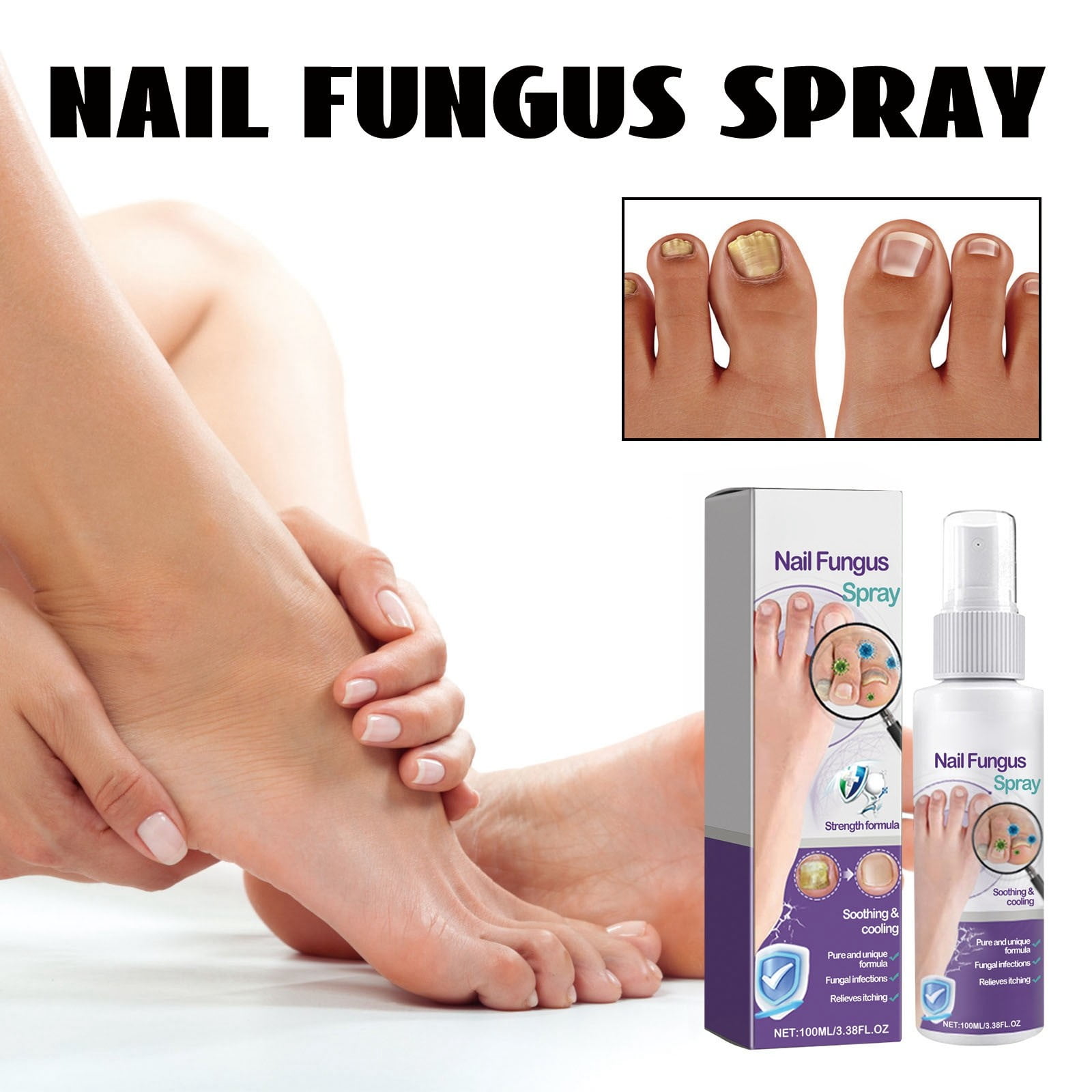 foot peel mask Gray Nail Spray Foot & Nail Spray For Toenails & Nails Strengthener 100ml