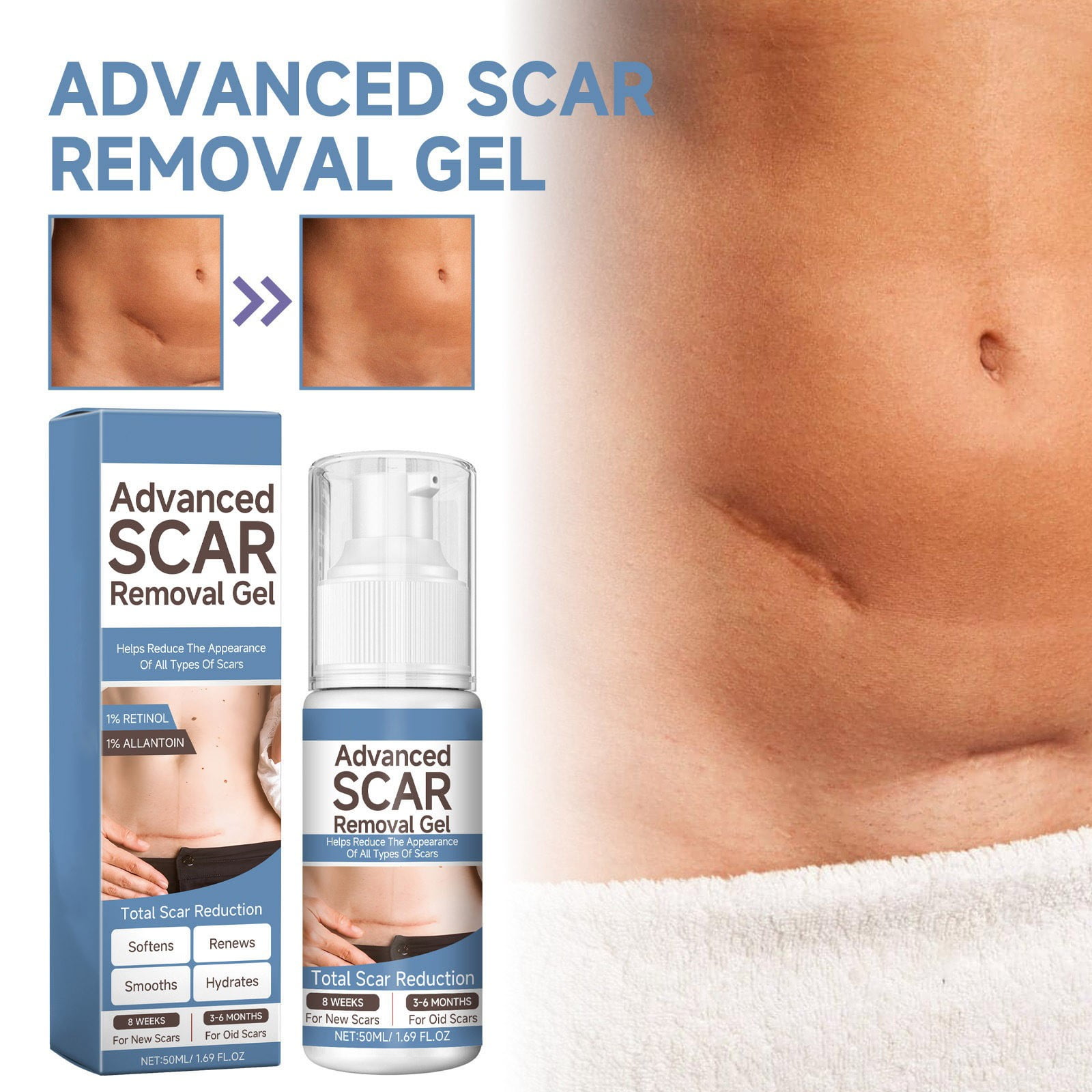 for Face New Face Scar Desalination Gel Moistens And Smoothes Skin Scar