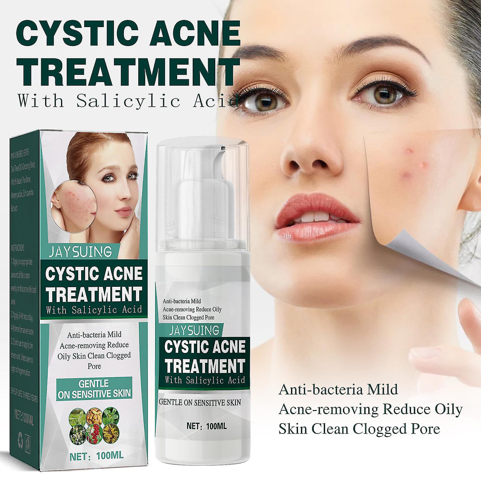 jaysuing salicylic acid cystic acne cream to remove acne, closed mouth acne, acne marks, facial