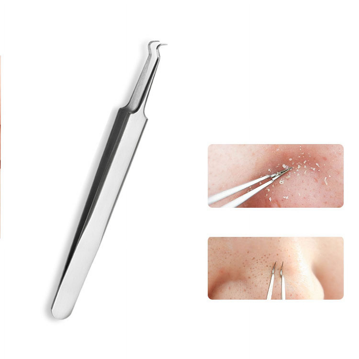 stainless steel acne clip acne needles to remove blackheads beauty