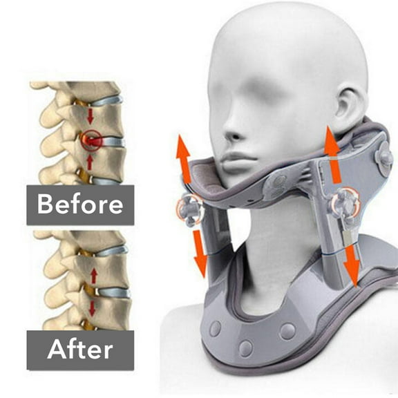 suidie Cervical Traction Device Adjustable Ergonomic Heat Treatment Electric Comfortable Pain Relief Portable Heating Neck Tractor Stretcher Posture Corrector for Home