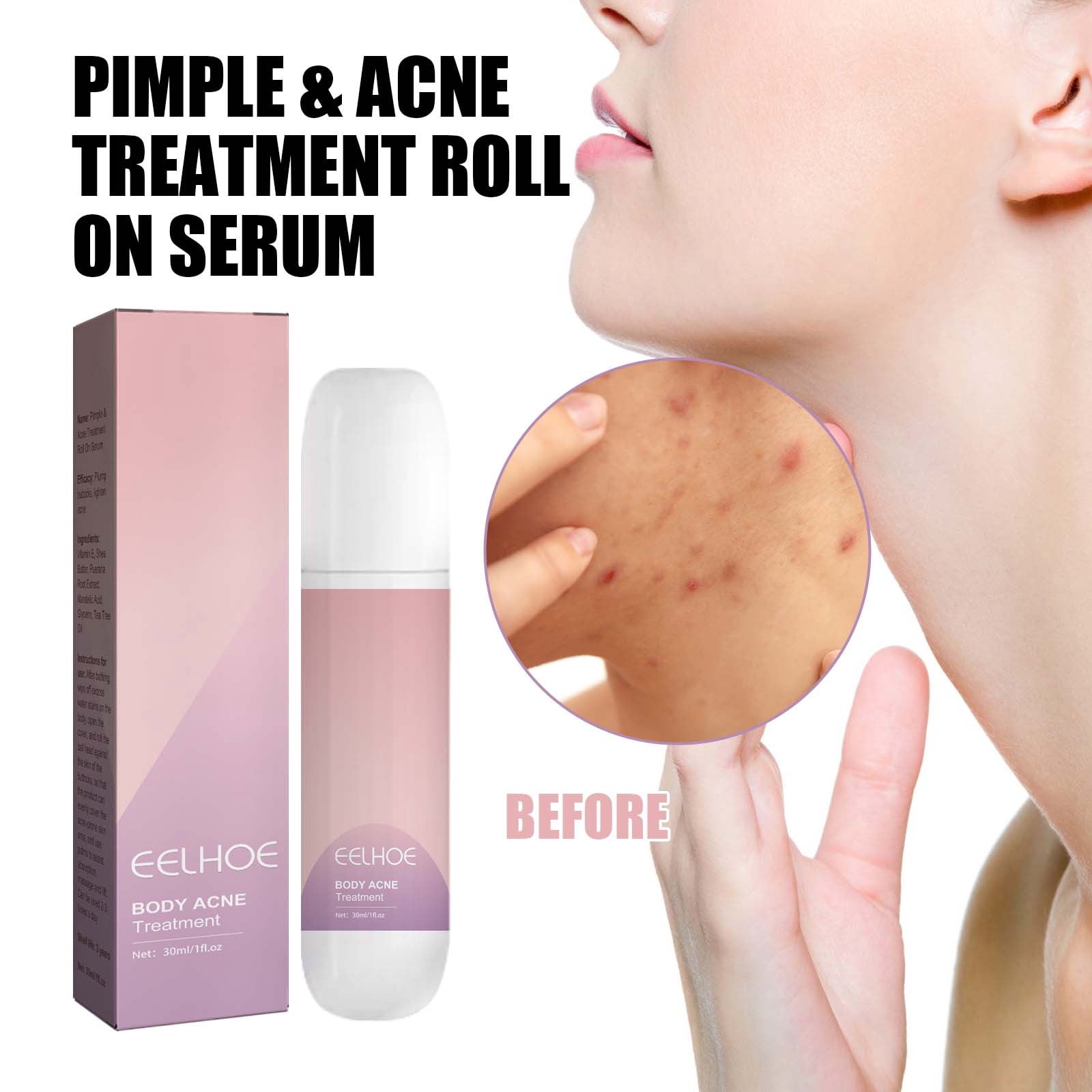 xaoyunyn Revitalize Skin with 1.01 fl oz Rolling Bead Exfoliator ...